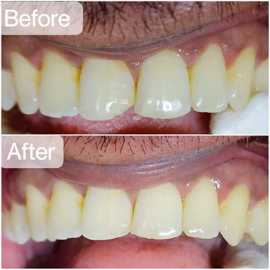 dental