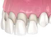 dental