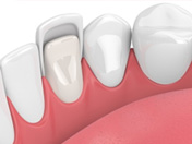 dental