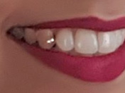 dental