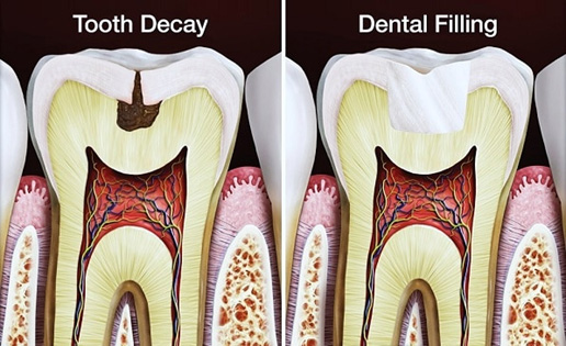 dental