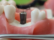 dental