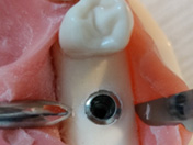 dental