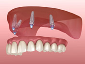 dental