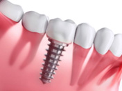dental