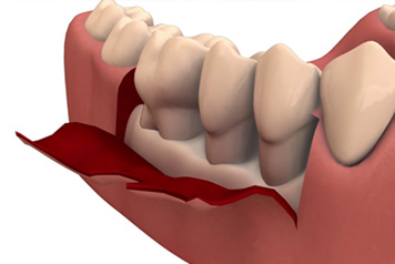 dental