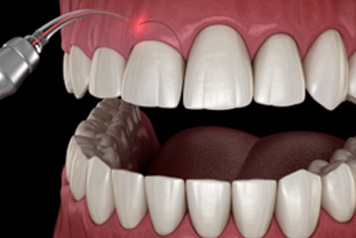dental
