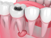 dental