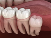 dental