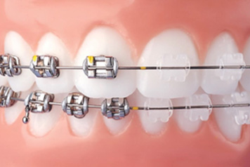 dental