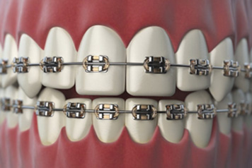 dental