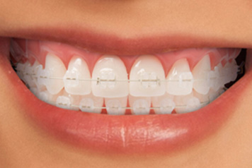 dental