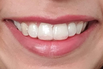dental