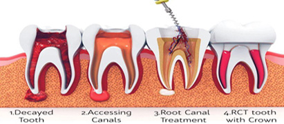 dental