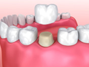 dental