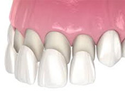 dental