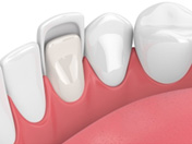 dental