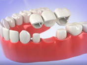 dental