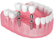 dental