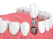 dental