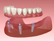 dental