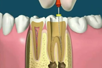 dental