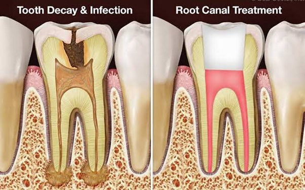 dental