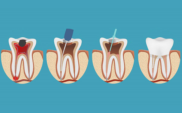 dental