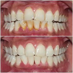 dental