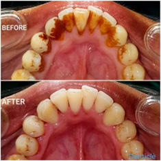 dental